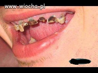 Byłeś u dentysty? A kto to?