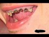 Byłeś u dentysty? A kto to?