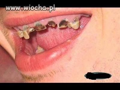 Byłeś u dentysty? A kto to?