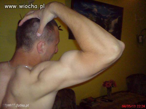 Szpan na mięśnie 