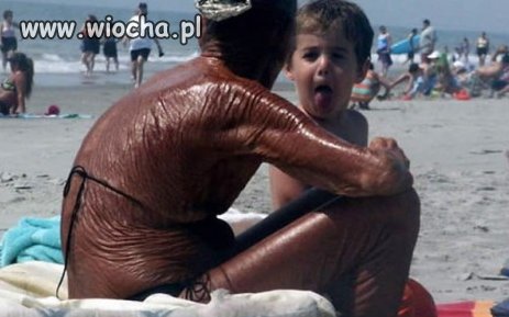 Spalona babcia. Opalanie jest dla mądrych ludzi...