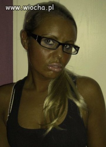 Solara i botox