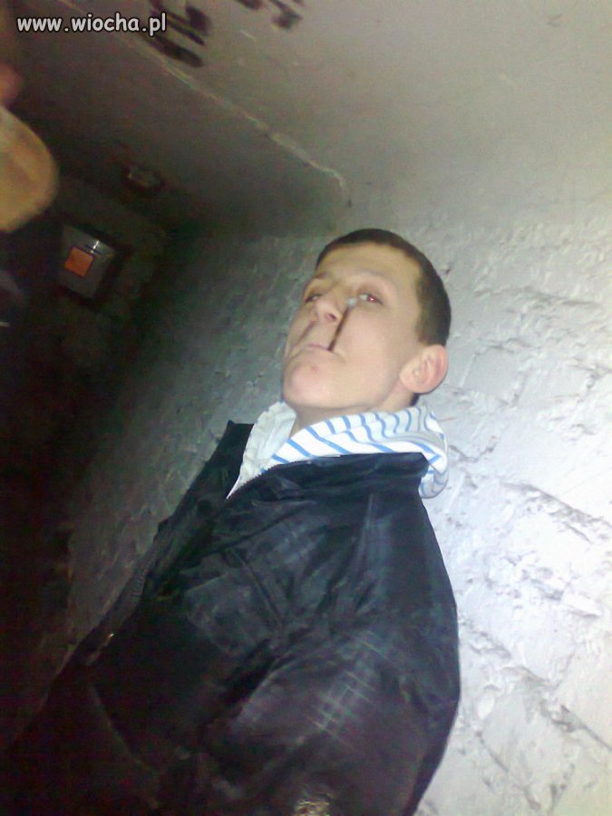 Szpan na NK