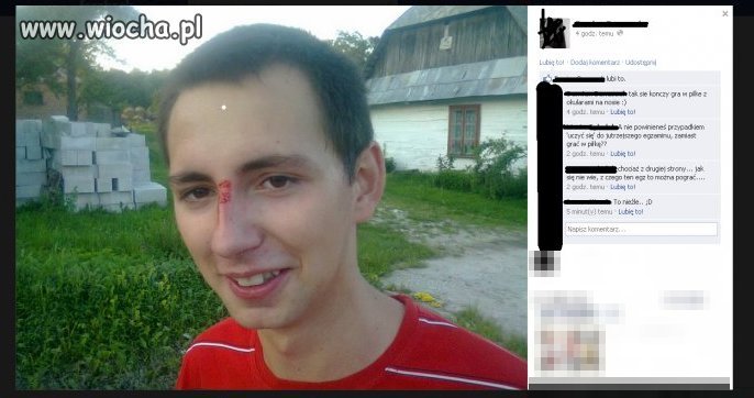 Chyba bolało, ale pochwalić się trzeba 