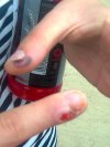 Wiocha jak nasi lekarze nie umieją