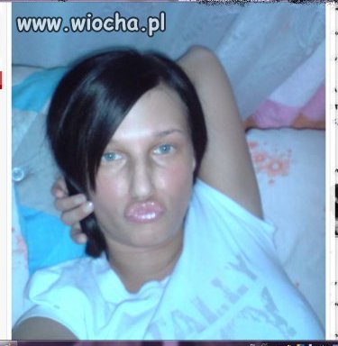 Biedaczka cierpi na 