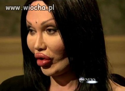 Oszpeciła się