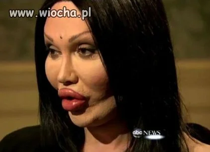 Oszpeciła się