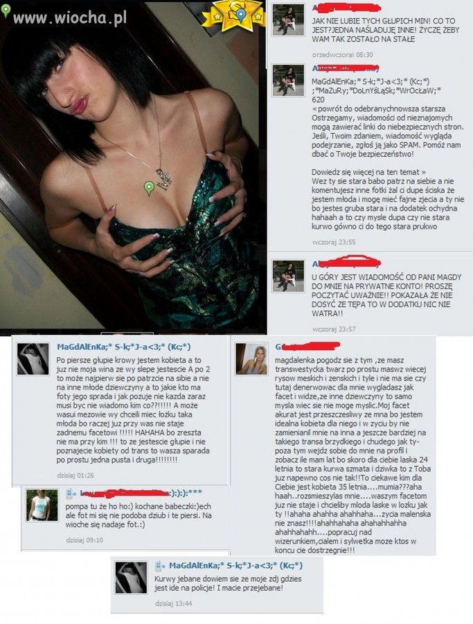 20-kilogramowy anorektyk z "dzióbkiem"