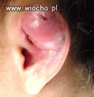 Piercing-