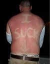 I suck 