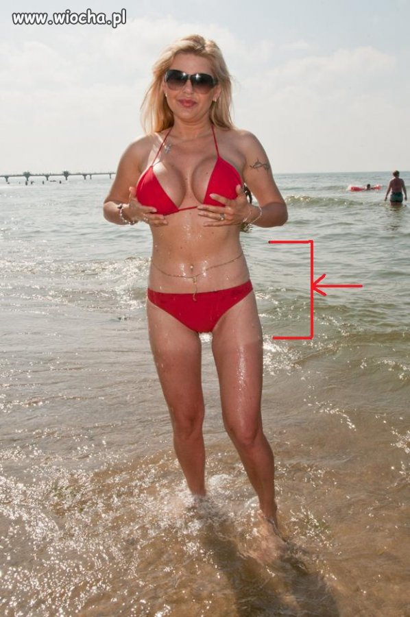 Iwona W. i jej opalenizna
