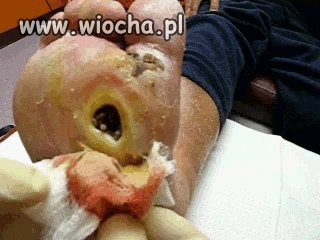 Jak można doprowadzić się do takiego stanu???!!!