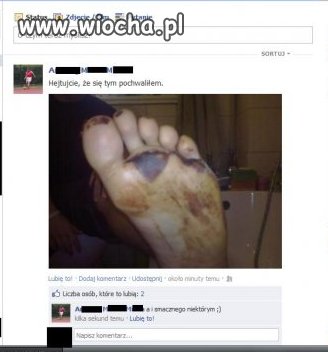 Mam rozje***ą stopę