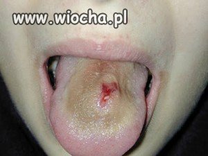 Fuuu