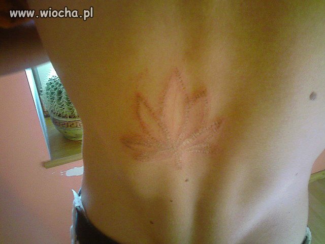 Po co on coś takiego sobie zrobił?