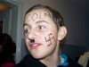 Adolf