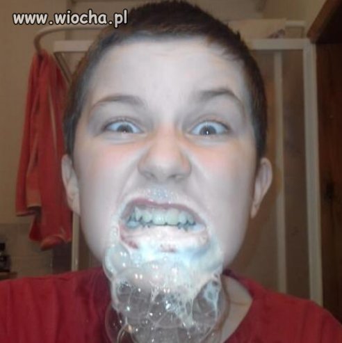 Wścieklizna ? 
