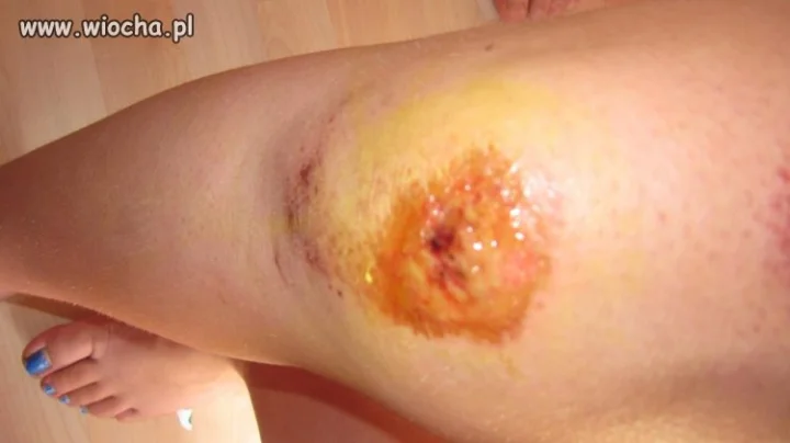 Jak tym się na facebooku można chwalić!!
