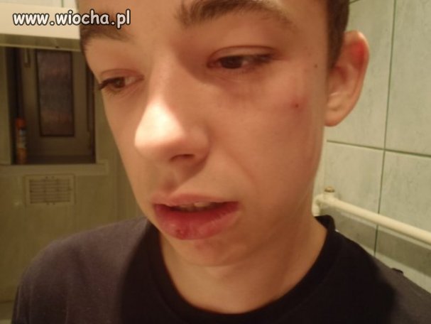 Policjanci pobili 17-latka