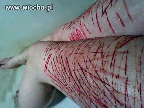 Czy to jest normalne?