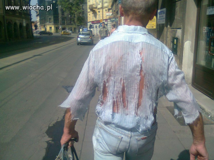 Ma Pan dziurę na koszuli 