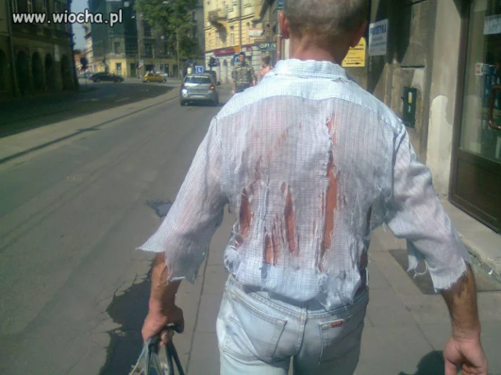 Ma Pan dziurę na koszuli 