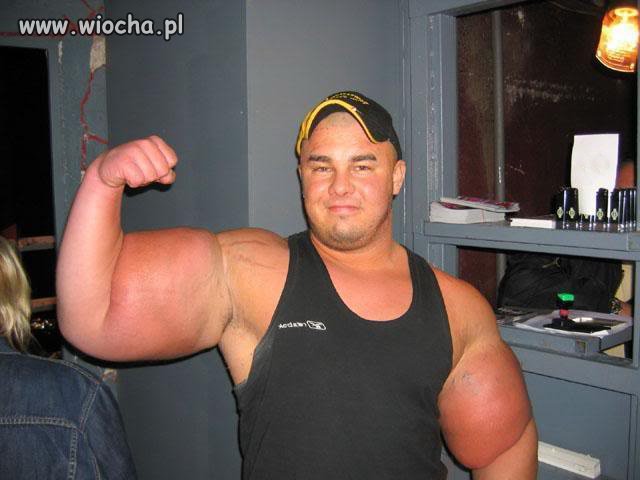 Synthol to całe moje życie...