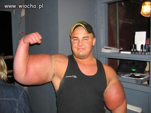 Synthol to całe moje życie...