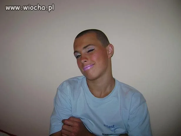Zanik płci