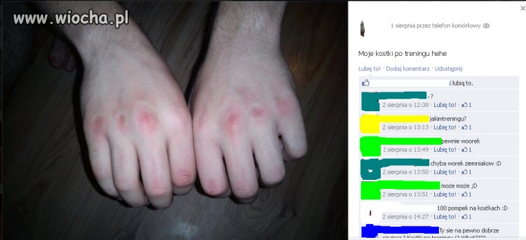 Moje kostki po treningu a w tle ta brudna stopa...