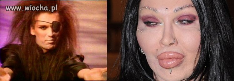 Pete Burns. Ja się pytam co on z sobą zrobił?