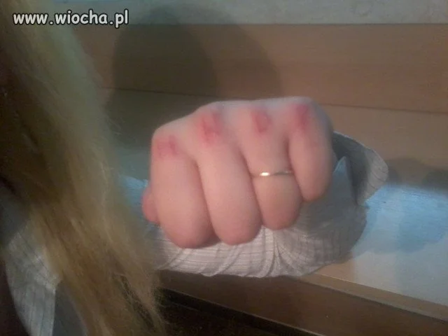 HWDP