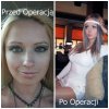 Ale się oszpeciła 