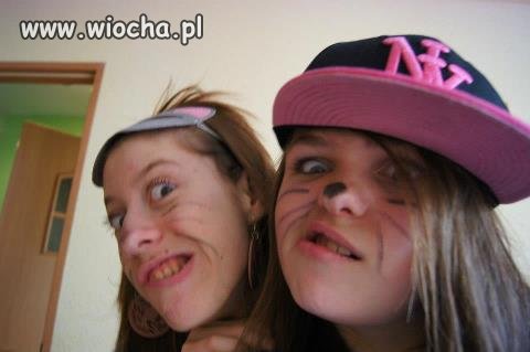Skrzywienie 3 stopnia? 