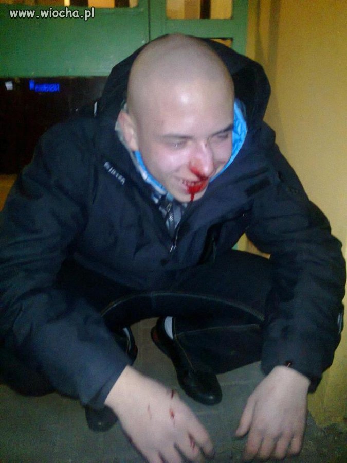 No miał się czym 
