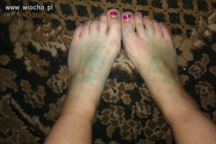 Przydałby się pedicure