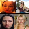 Dzióbek + botox = główna
