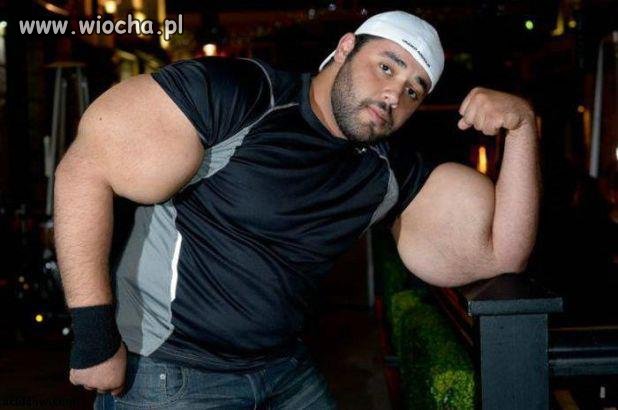 No i więc co synthol robi z ludźmi 