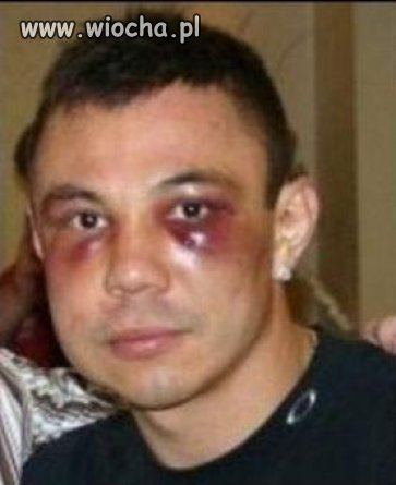Obili Ci ryj???