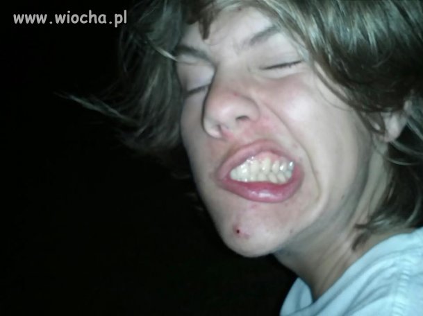 Walka z pryszczem