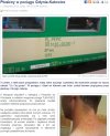 Pluskwy w pociągu PKP...