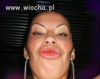 Kolejna Panna botox