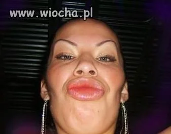 Kolejna Panna botox