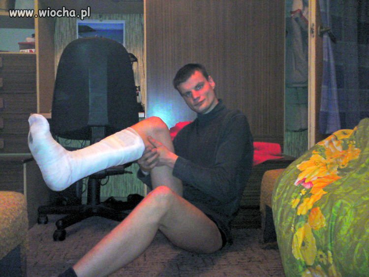 Mam noge w gipsie. I musze się tym pochwalić. 