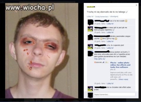 Troszkę mu się oberwało...