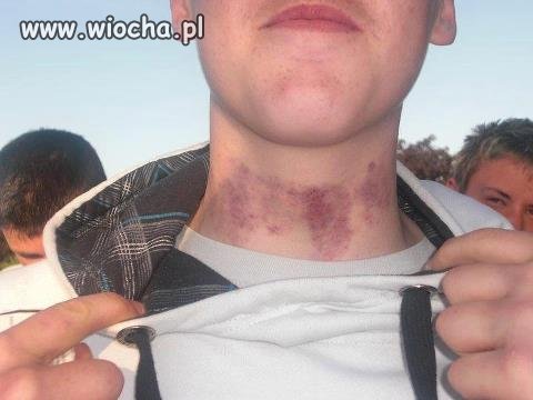 Tak się do mnie przyssała
