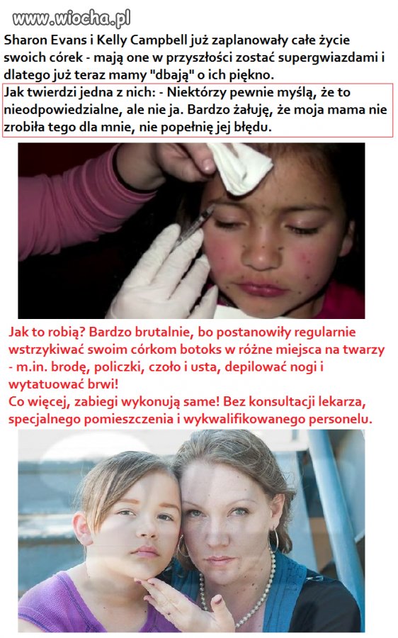 Botoks u dzieci