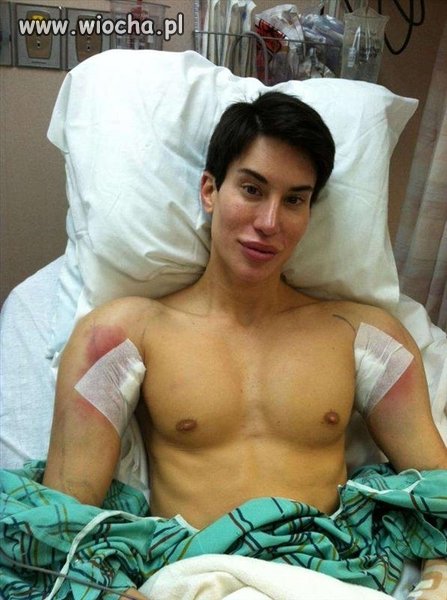 Justin Jedlica, 100 tysięcy dolarów, sto zabiegów: