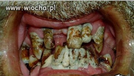 Piękne zęby